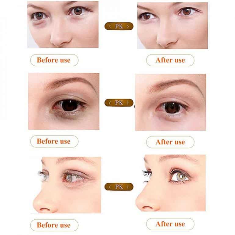 ejemplos de los resultados del contorno de ojos